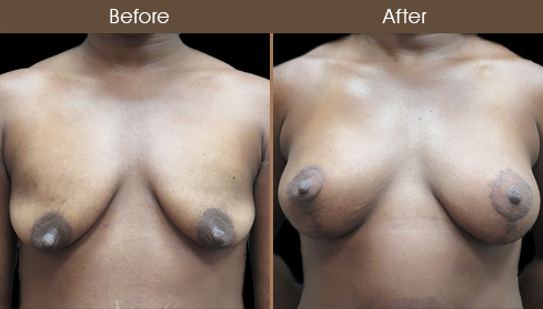 20202705190917_B63-Front